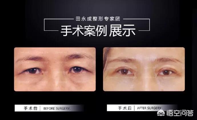 化妆技巧眼皮松弛

