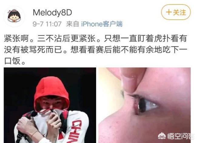 [因鸡蛋崩溃女子发声]贤内助终于发声！妻子晒周琦眼角伤病照，亲自回应“鸡蛋灌饼”梗，你怎么看？