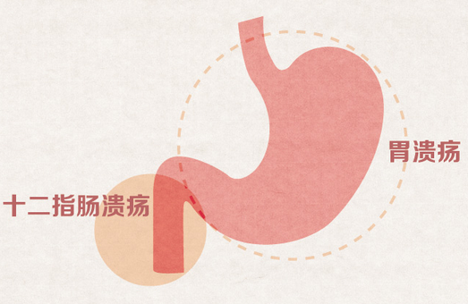 胆囊炎能吃花胶吗 2026年胆囊炎能吃花胶吗女性