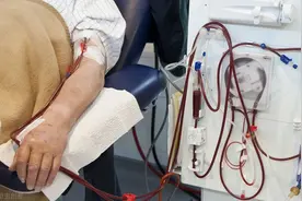 什么是透析，透析痛苦吗？一旦透析就要终身透吗？图片