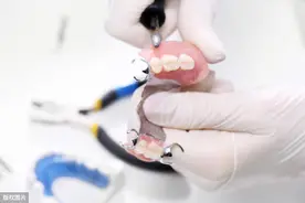 老年人佩戴活动假牙，你得先知道这些，不然伤害牙龈还有异味图片