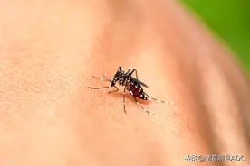 被蚊虫叮咬后想消肿止痒？教你不用药物快速止痒图片