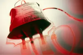 输血还会引起发热，究竟怎么回事？图片