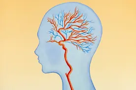 脑胶质瘤的预后转归与护理要点及饮食图片