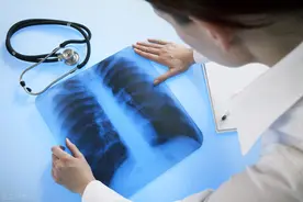 什么是肺大疱？分类与临床表现和治疗方法？4点措施预防气胸图片