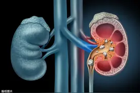 52岁男腹痛，医生怀疑阑尾炎，剖开了他肚子后傻眼了，不是阑尾炎图片