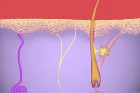 毛囊炎是什么引起的，为什么老是治不好，需要注意哪些问题？图片