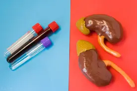 都说肌酐升高代表肾出问题？肾内科医师解释给您听，快快收藏起来图片