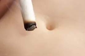 灸“倒三角”固阳图片