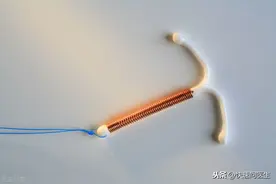 节育环要拿出来吗？什么时候取出很重要，医生告诉你答案图片