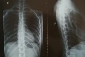 你练瑜伽怎么把胸椎练直了？细谈瑜伽课的“思维革新”图片