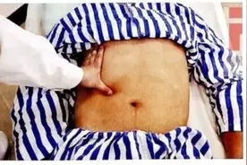 医院误诊，家属崩溃......血的教训，年过30的人必须警惕图片