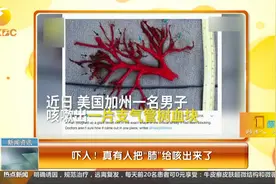 吓人！真有人把“肺”给咳出来了