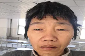 保定救助站：中年女子被救助，高1米65，患智力障碍，疑似精神异常图片