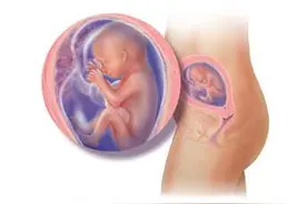 第70课：如何催产图片