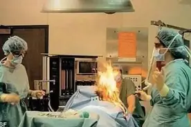 手术中病人不小心放了个屁，接着就起火了，接着病人又受伤了视频封面