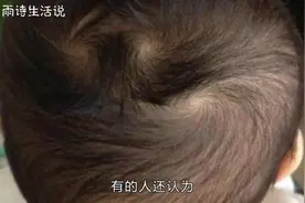 孩子头上的头旋个数代表了什么？做父母的要知道！视频封面