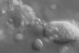 科学家利用3D技术首次拍下癌细胞侵食健康细胞过程图片