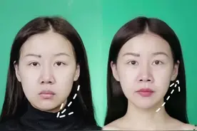 专门针对下垂脸的按摩方法#防下垂 #一起按摩按摩