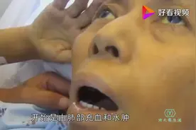 人死前咽下最后一口气，到底有多难受？看完心情复杂视频封面
