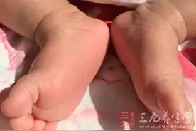 脚趾这儿能看出癌症图片