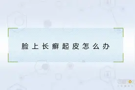 专家科普：脸上长癣起皮怎么办
