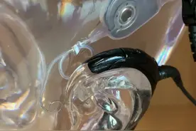 好多人好奇人工耳蜗是如何吸在头上的，前几天带洛西去调机就拍了这个视频，手指的地方就是植入耳蜗的电极视频封面