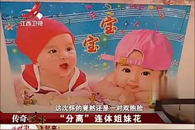 妻子产检发现异样，丈夫害怕妻子心里受打击，居然没有告知实情视频封面