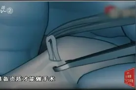 男子跑多家医院要结扎，却都被医生拒绝，没想到背后原因让人意外视频封面