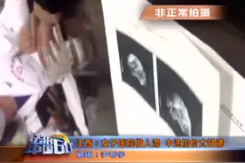 医生用医用仪器狠狠地按压女子身体，女子疼痛难忍大声求饶视频封面