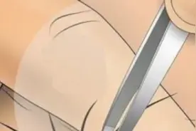 腋毛不能拔？操作稍有不慎就会酿大错，爱美也不要冒然动手