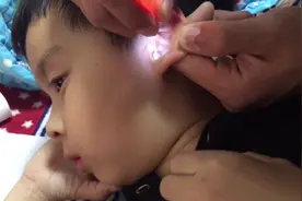 父母8年没给孩子掏过耳朵，今天一看耳朵都堵死了，难怪听力不好视频封面