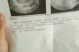 月经推迟是不是病，可一旦推迟就担心得要命！图片