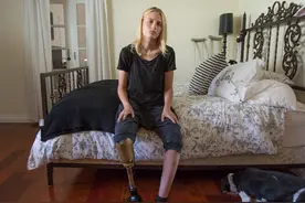 身残志坚：这个独腿超模女孩活得真漂亮！图片