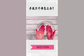被染色的手洗不干净怎么办？快收藏一下#生活小妙招 #抖音小助手