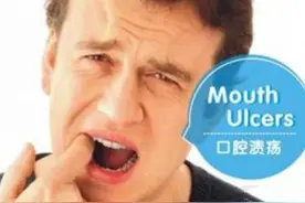 中老年口腔专科医师提醒：口腔溃疡也是病，得尽早治！图片