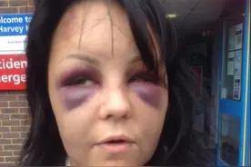 阴险！男子假装身患癌症诱骗前妻至家中，将其暴打近残！图片