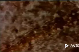 显微镜下免疫细胞消灭细菌、病毒、癌细胞，清扫细胞残骸的过程。视频封面