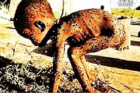 看看非洲的饥饿儿童，痛心。图片