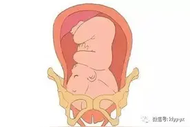 分娩｜胎头下降的早晚，主要还得看它图片