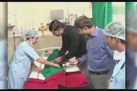 印度男孩长有一条尾巴，测量竞达18厘米视频封面