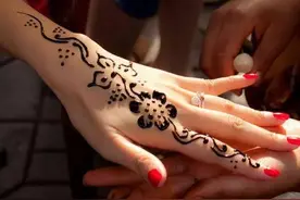 海娜纹身虽美，却让这孩子胳膊长满水泡，你还敢尝试吗？图片