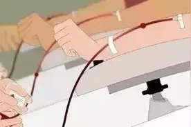 为何提倡一次献血400毫升？图片