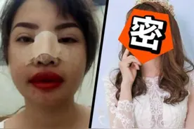 “越南凤姐”相亲时吓跑男方，花十万怒整容后嫁富二代，还要出道当明星！图片