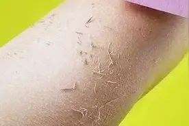 教你搓掉身上的“泥”，搓掉它就是搓掉身上的湿气！