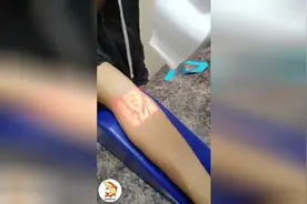 护士再也不会找不到血管位置了，平常人都能看到血管位置的黑科技