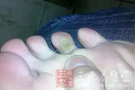 关于脚的事情，你知道多少？图片