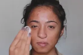 毁容妹纸化妆，秒变女神，看到美美的自己感动哭了