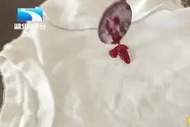 简单两招，洗掉水果渍！衣服和新的一样！