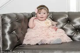 美母亲拍唐氏综合症患者感人特写 呼吁乐观面对图片